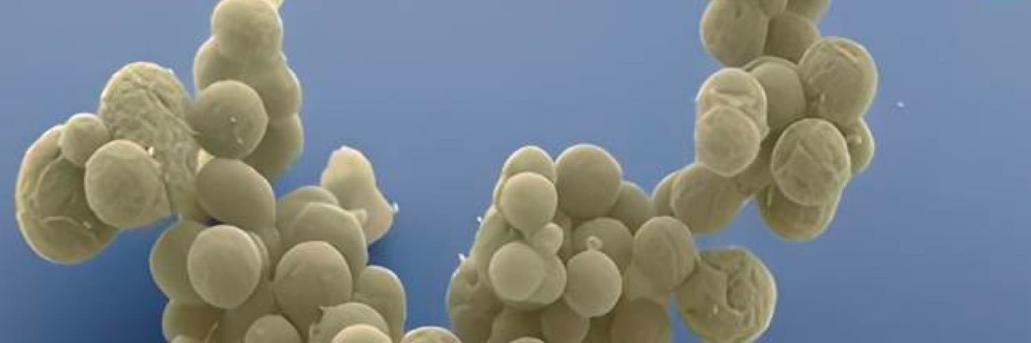 Fotografía de microscopio. Varias estructuras esféricas en cadena.