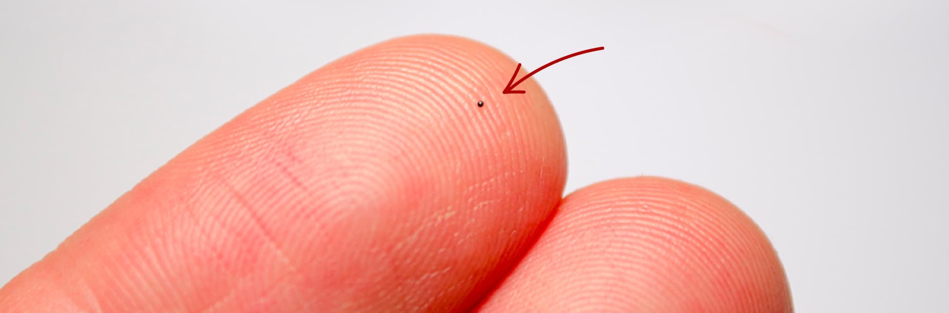 Foto. Sobre la yema del dedo de una mano humana aparece un pequeño punto casi imperceptible señalado por una flecha roja.